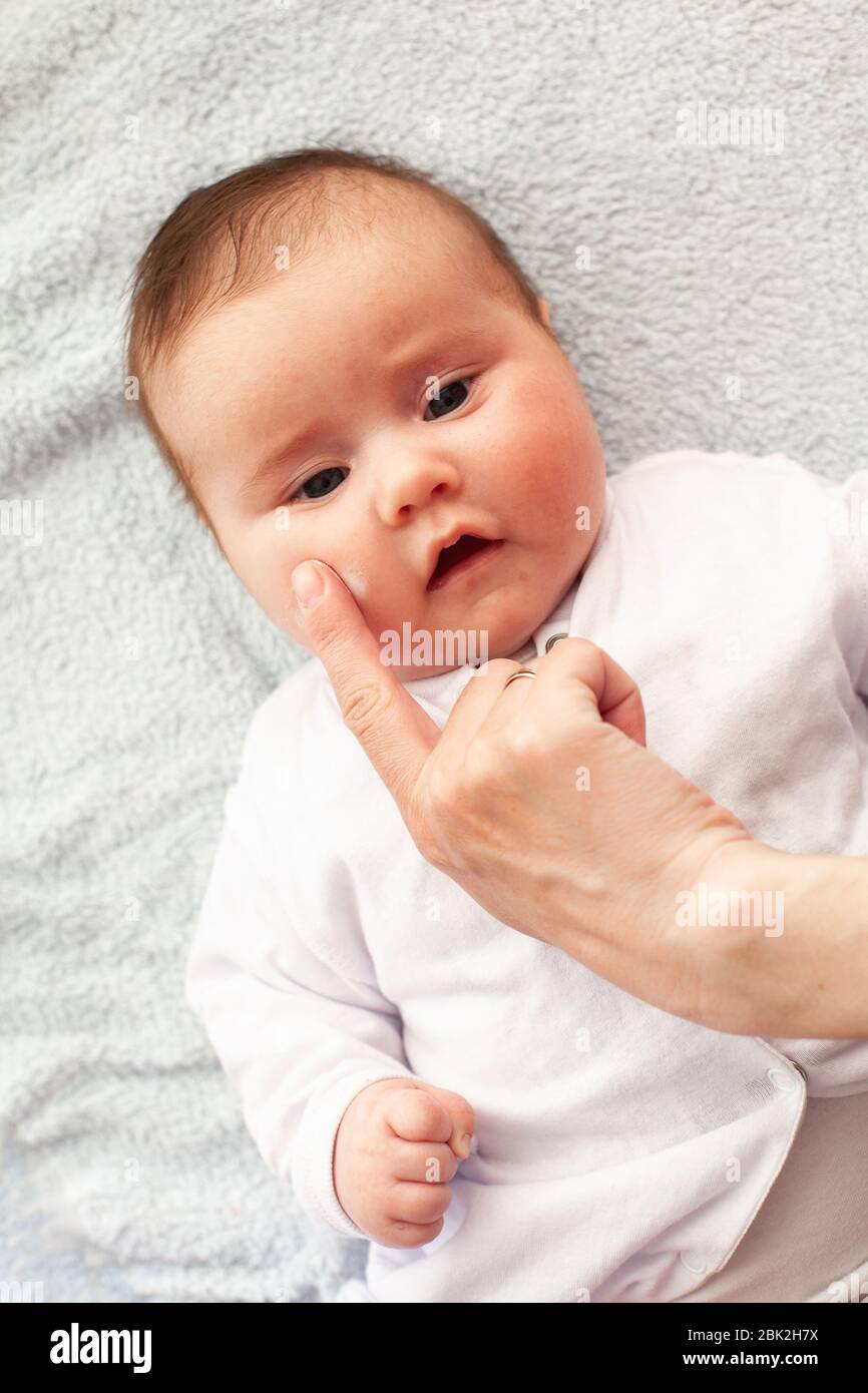 Bebe Avec Dermatite Atopique Obtenir Creme Mettre Soins Et Prevention De L Eczema Gardez Votre Bebe A L Ecoute Photo Stock Alamy