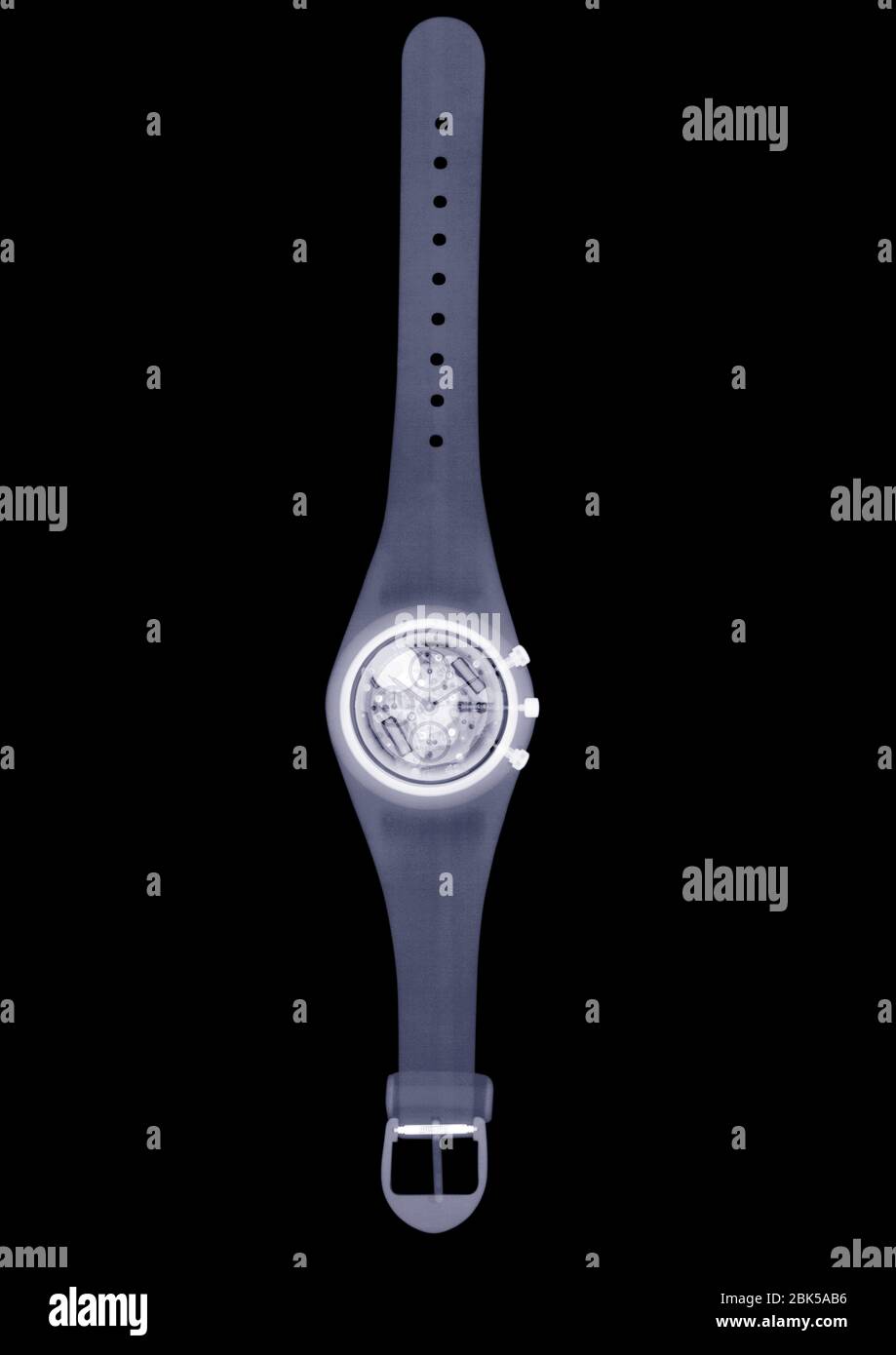 Montre-bracelet, rayons X. Banque D'Images