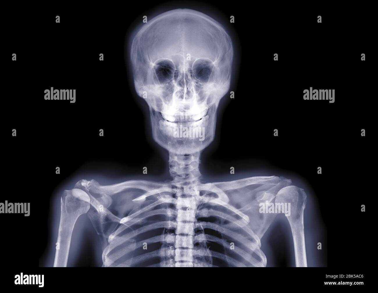 Crâne et épaules souriants, rayons X. Banque D'Images
