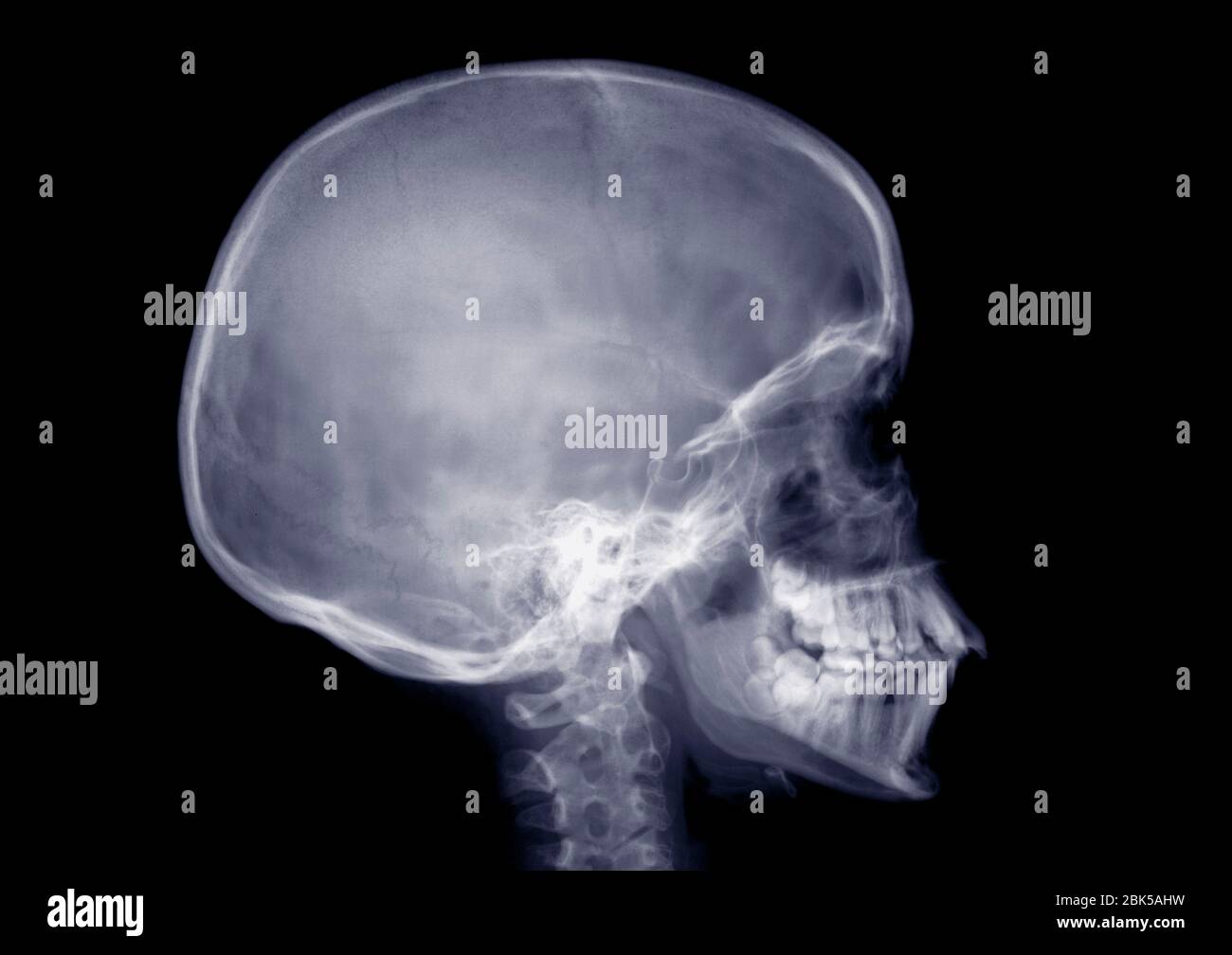 Crâne humain du côté, rayons X. Banque D'Images