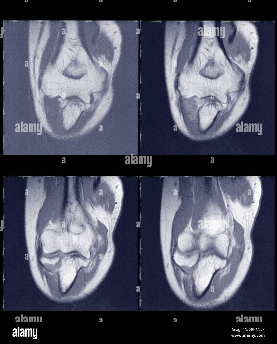 Section transversale de l'articulation de la cheville, IRM. Banque D'Images