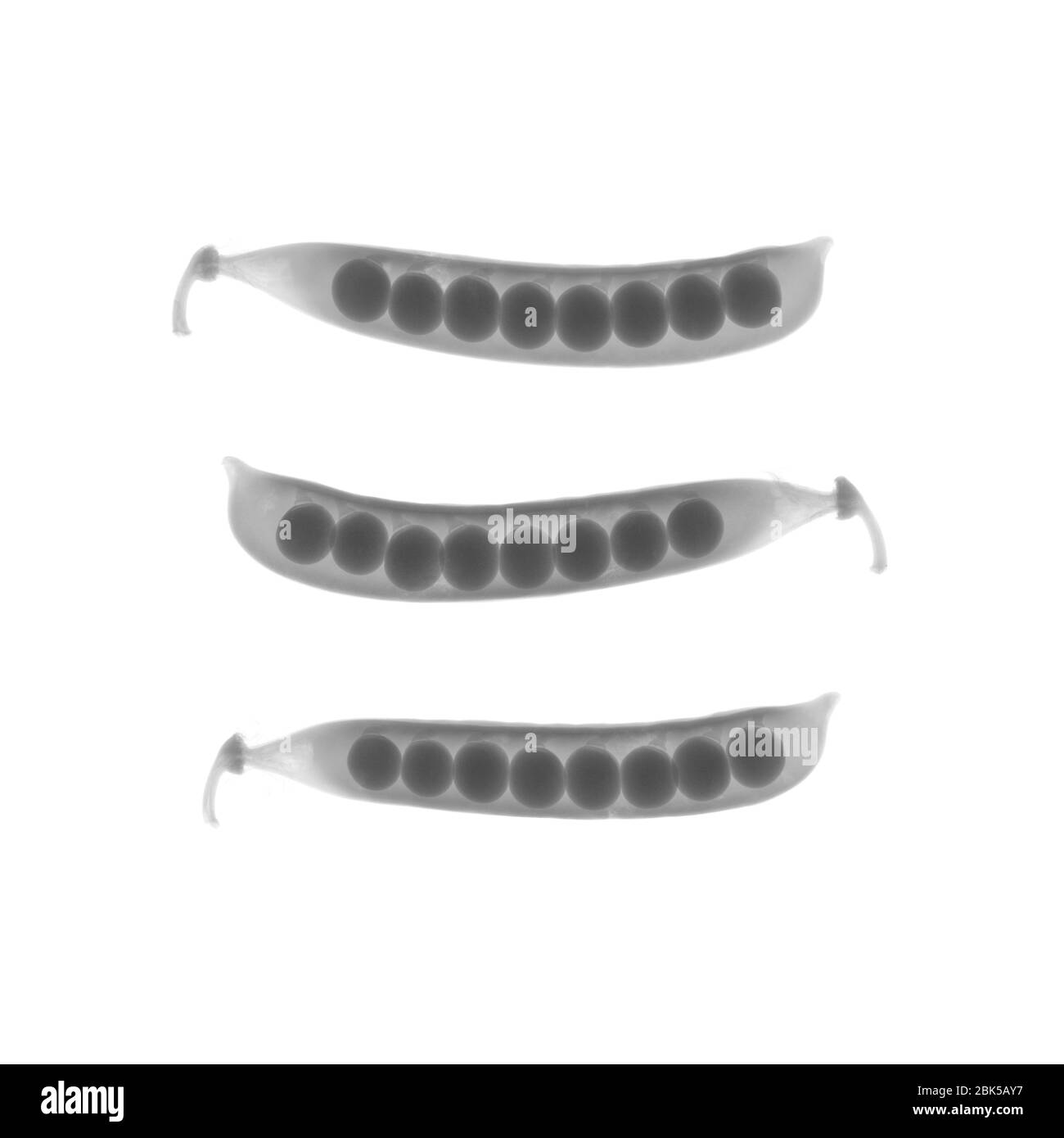 Rangée verticale de trois gousses de pois, rayons X. Banque D'Images