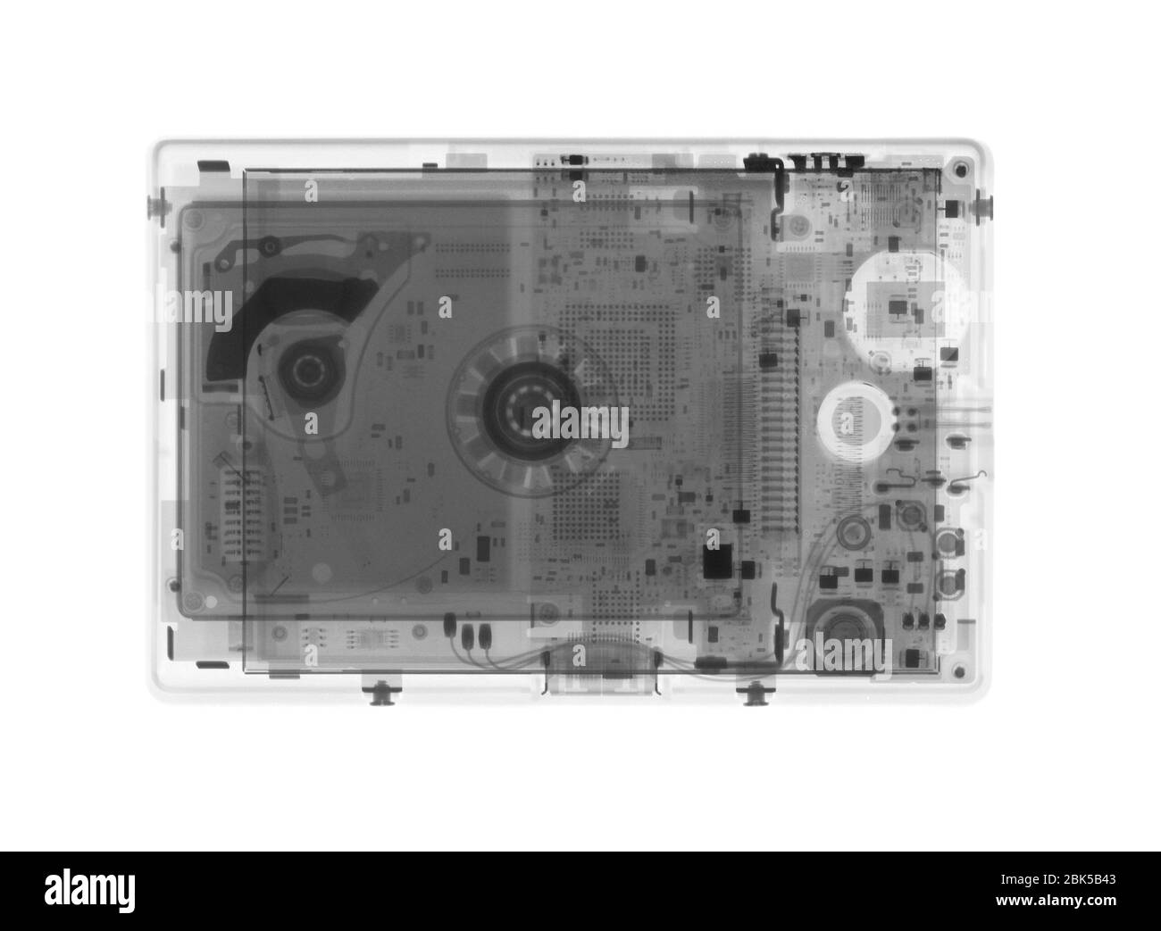 Appareil photo numérique, rayons X. Banque D'Images