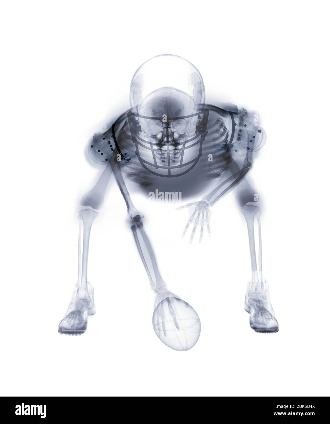 Squelette de joueur de football américain, radiographie. Banque D'Images