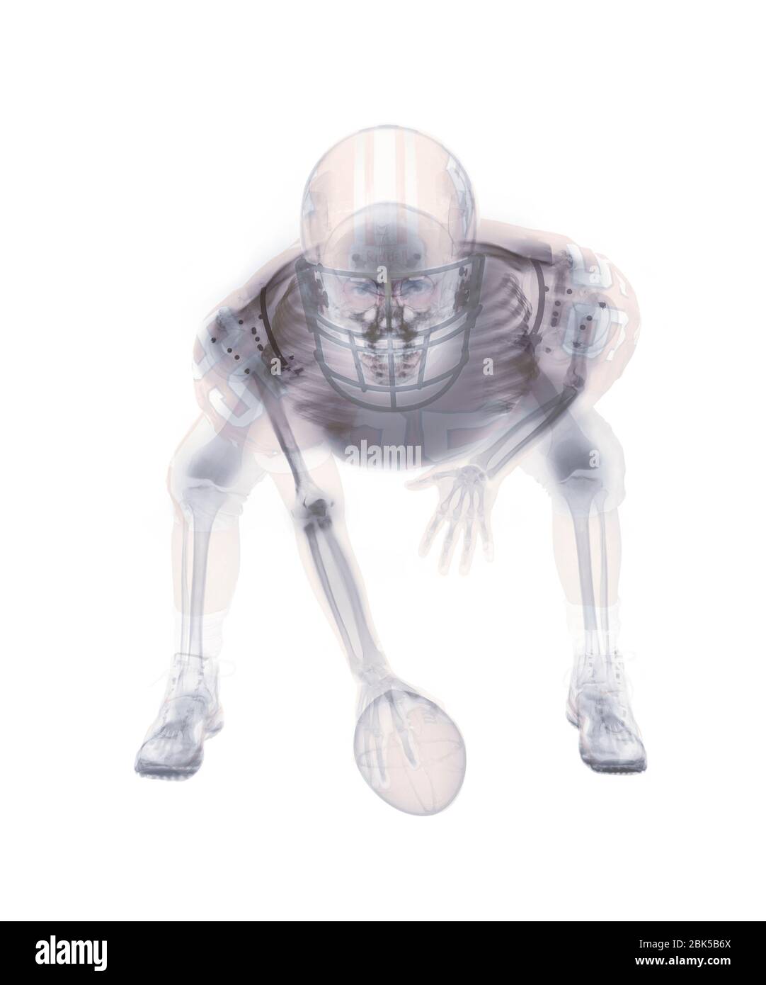 Squelette de joueur de football américain, radiographie. Banque D'Images