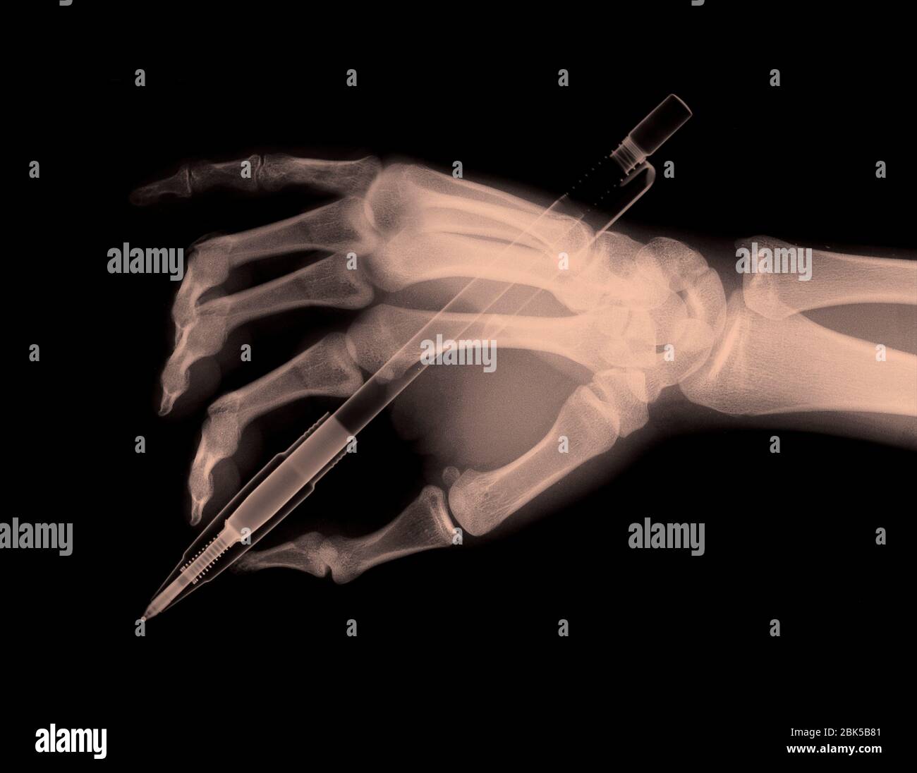 Écriture manuelle humaine, radiographie colorée. Banque D'Images