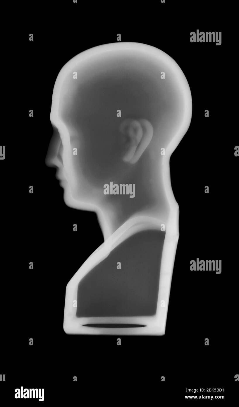 Modèle de phroenologie, radiographie. Banque D'Images