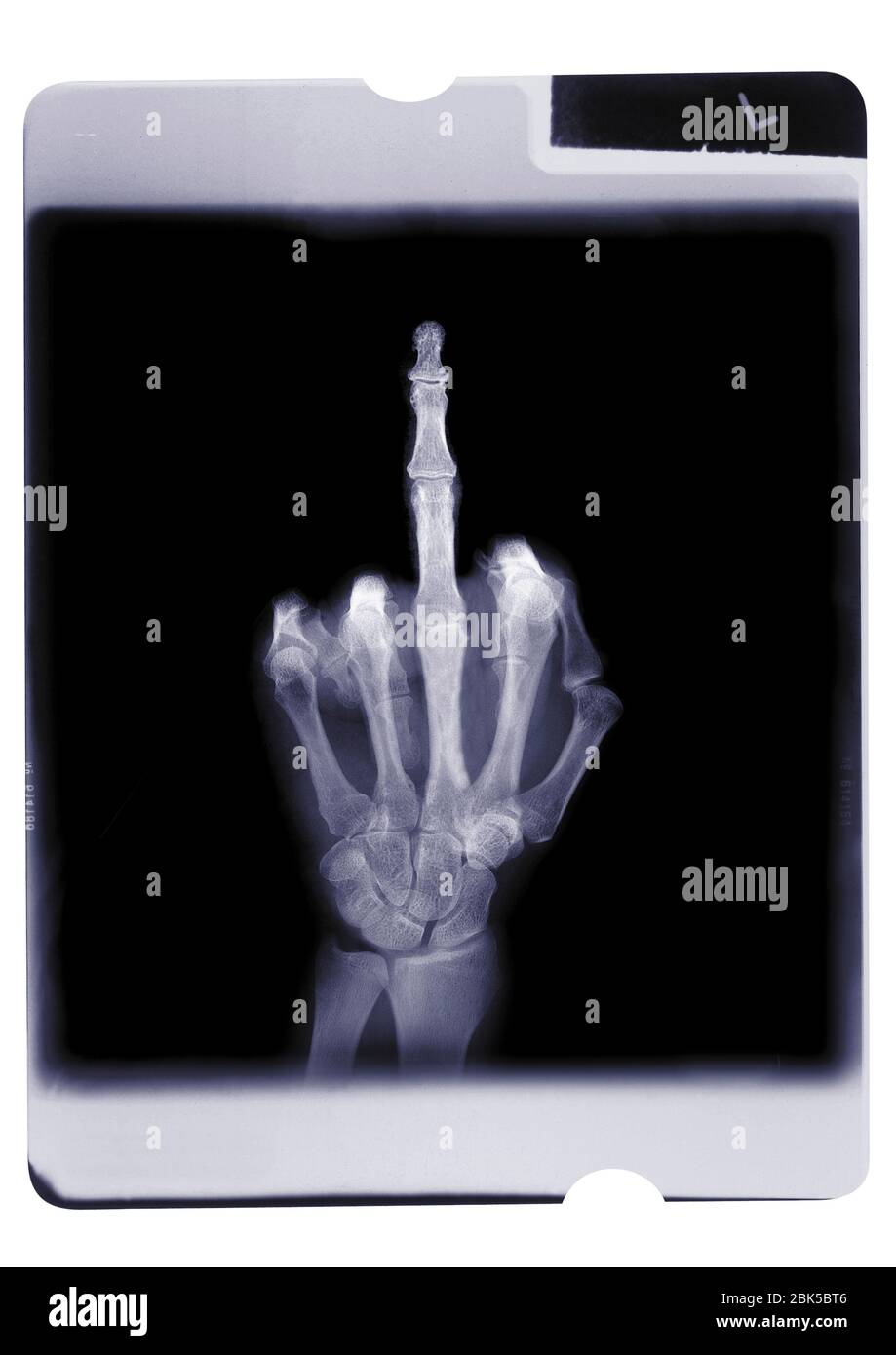 Main avec doigt central levé, rayons X. Banque D'Images