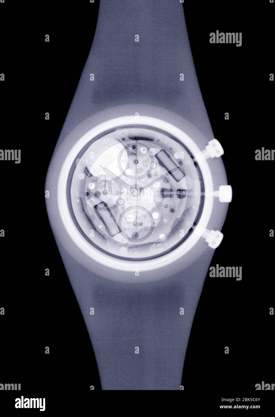 Montre-bracelet, rayons X. Banque D'Images