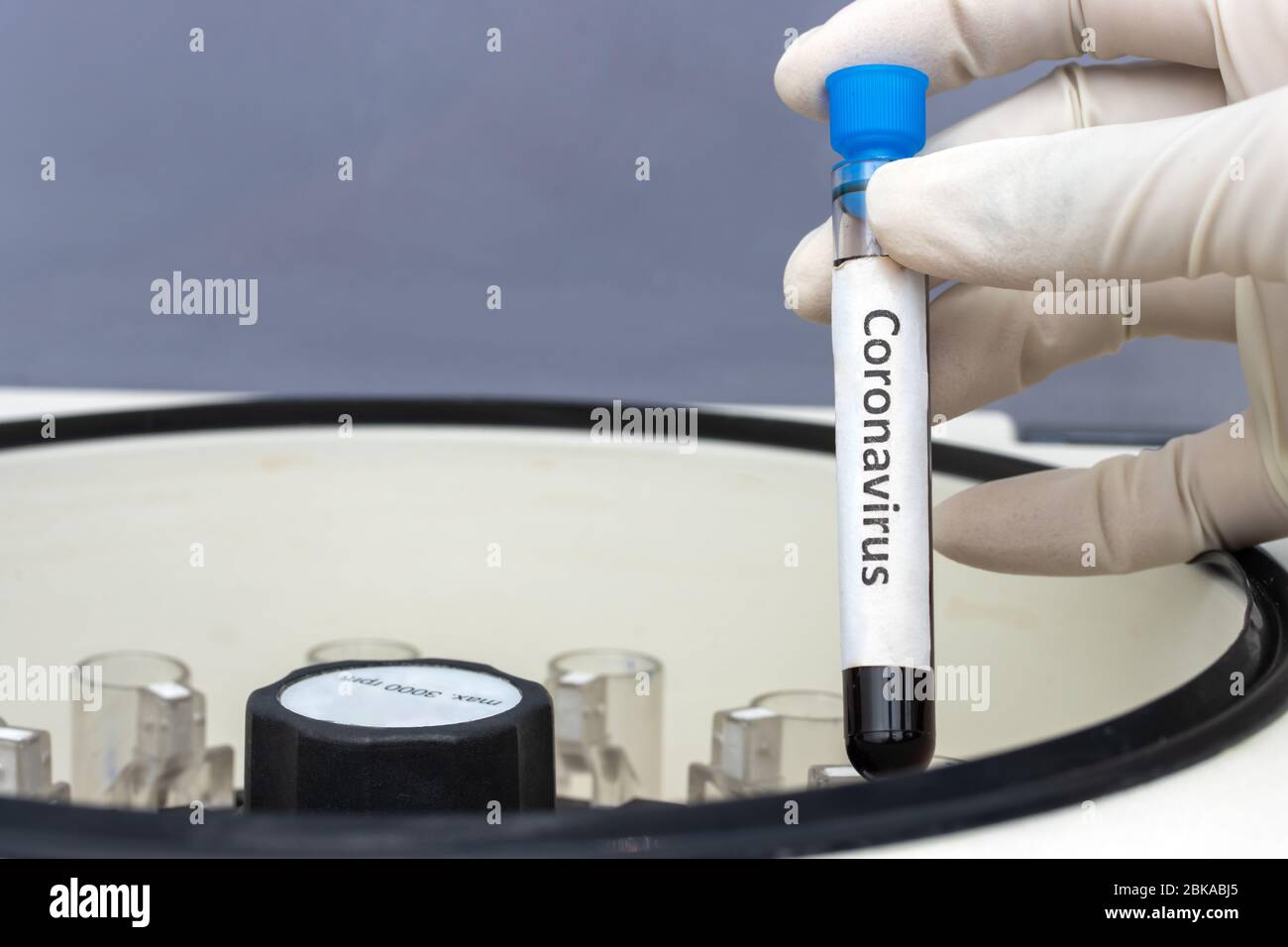 Recherche de virus dans les machines à centrifuger au laboratoire. Main dans le gant tenant un tube à essai avec l'inscription coronavirus. Contrôle de l'échantillon avec du sang i. Banque D'Images