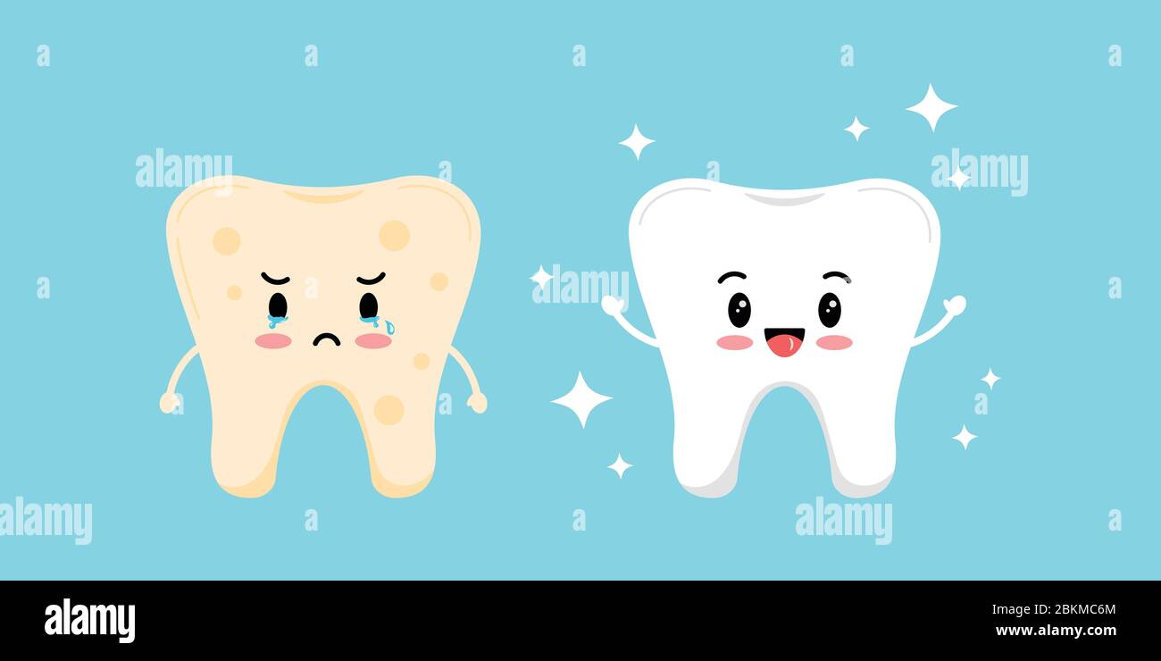 Jolie dent blanche et dent avec plaque de coloration jaune avant, après l'ensemble d'icônes. Illustration de Vecteur Jolie dent blanche et dent avec plaque de coloration jaune avant, après l'ensemble d'icônes. Illustration de Vecteur