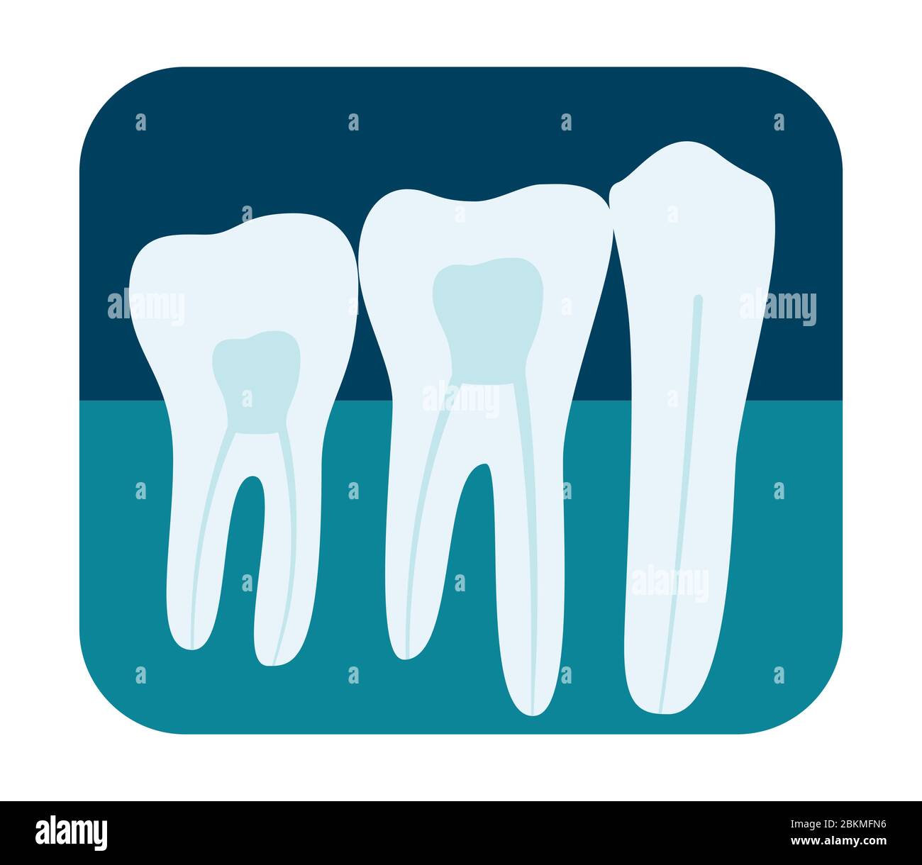 Rayons X des dents humaines. Trois molaires saines sur une radiographie. Illustration vectorielle Illustration de Vecteur