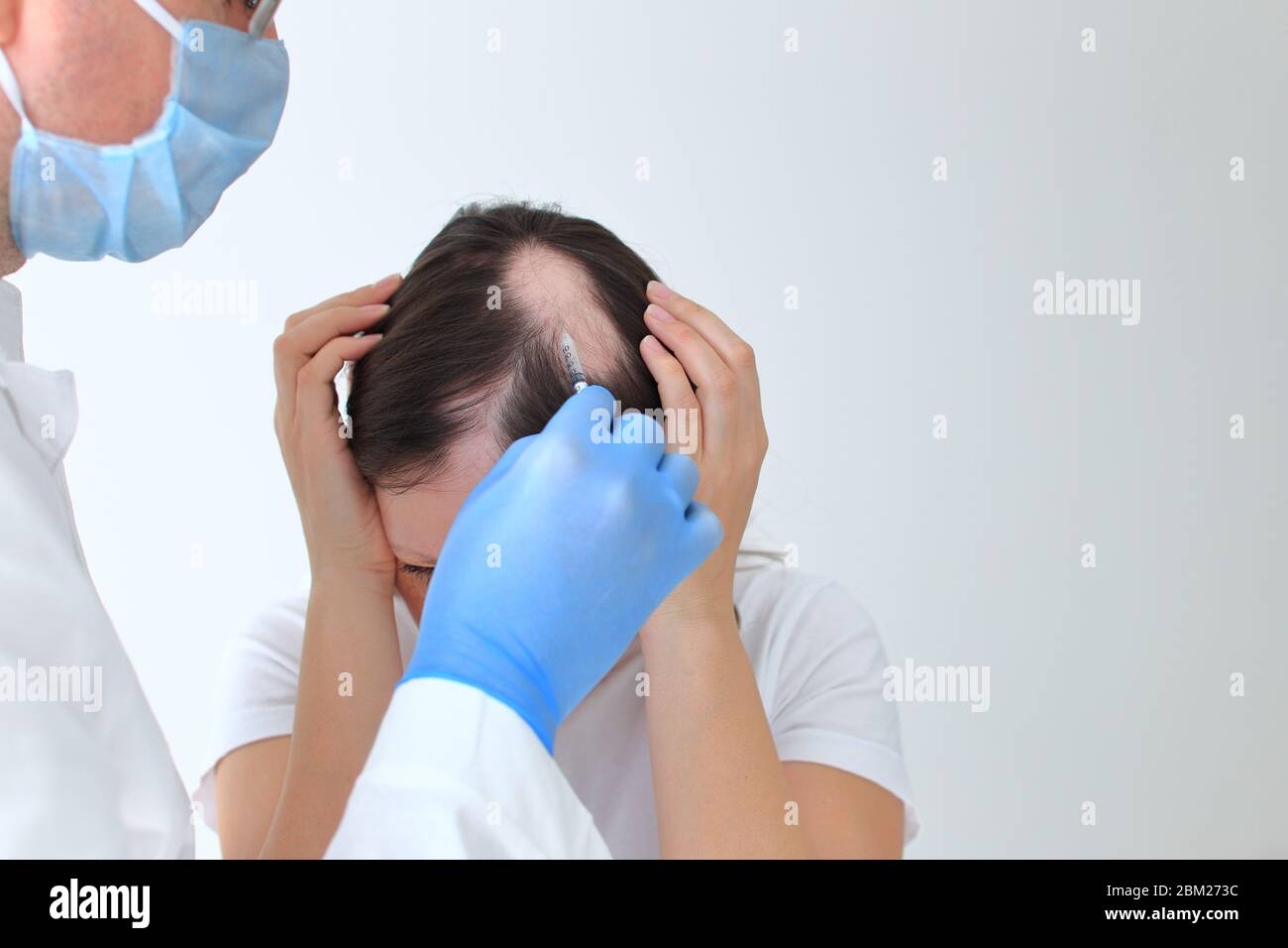 Les injections dans la tête chauve d'une fille. Véritable alopécie areata Banque D'Images