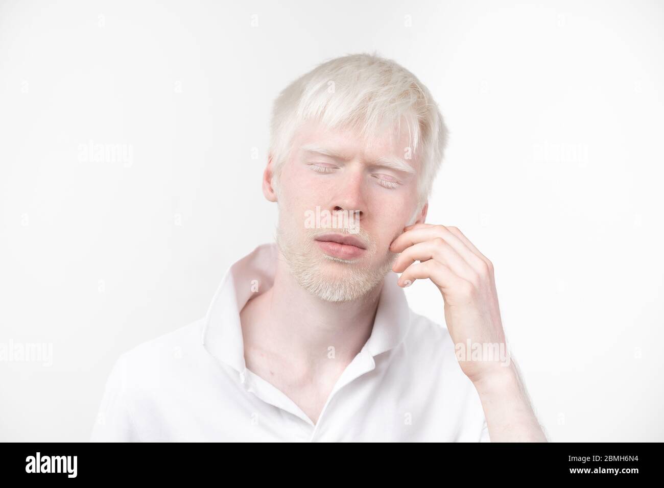 Portrait d'un homme albinos dans studio habillé t-shirt isolé sur un fond blanc. déviations anormales. Aspect insolite anomalie de la peau. Banque D'Images