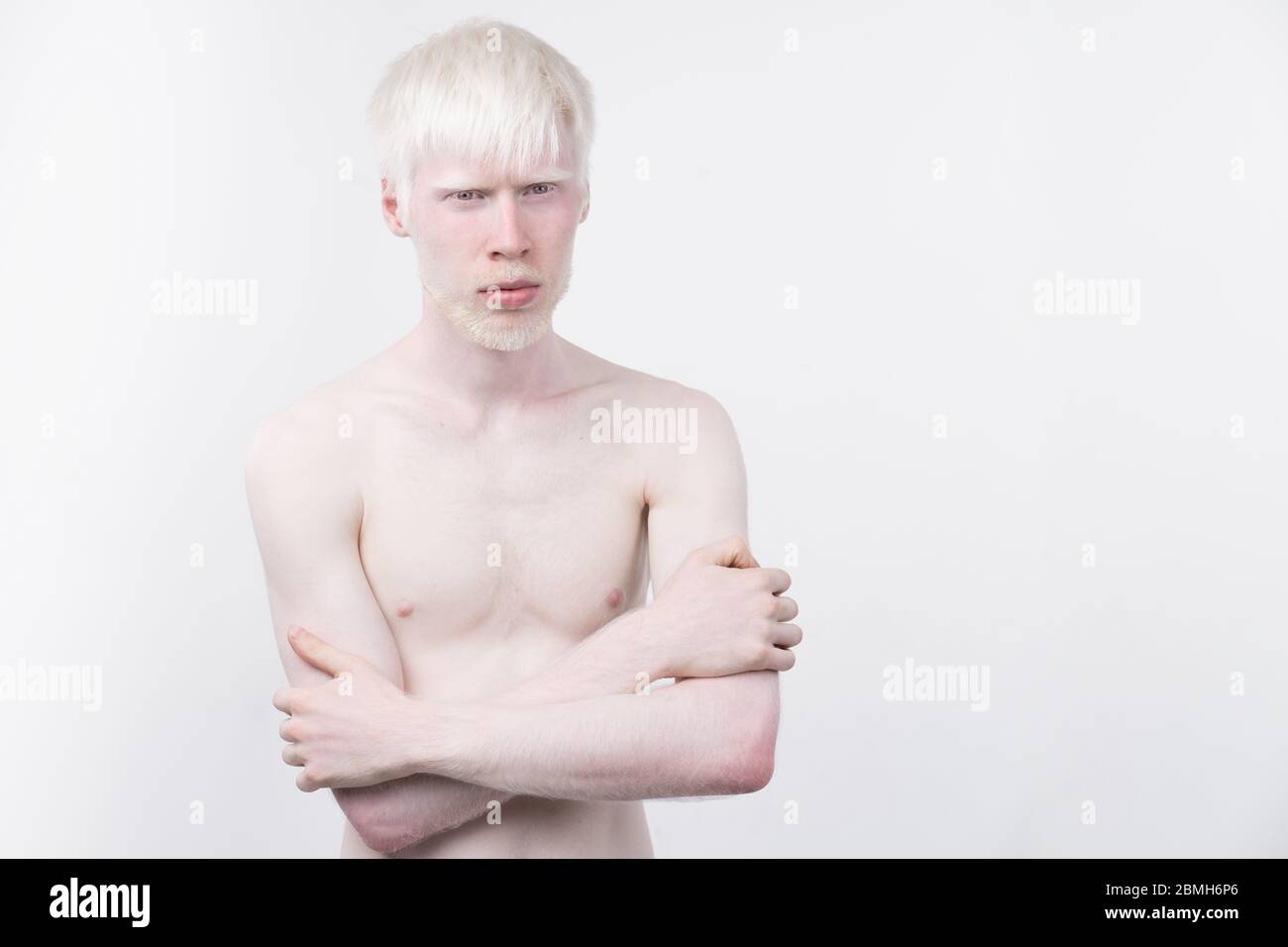 Portrait d'un homme albinos dans studio habillé t-shirt isolé sur un fond blanc. déviations anormales. Aspect insolite anomalie de la peau. Banque D'Images
