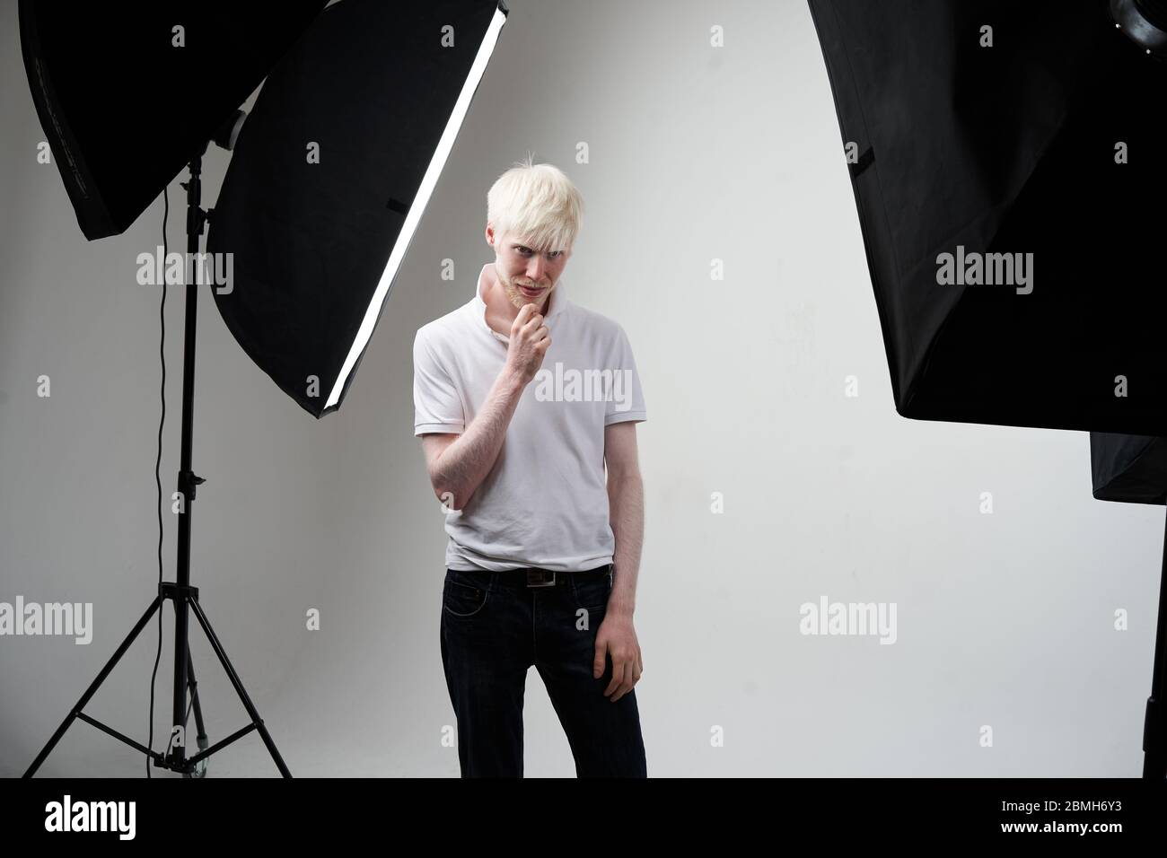 Grave albino homme peau blanche cheveux studio habillé t-shirt debout flash lumière. Déviations anormales. Apparence inhabituelle. Peau anomalie belle pe Banque D'Images