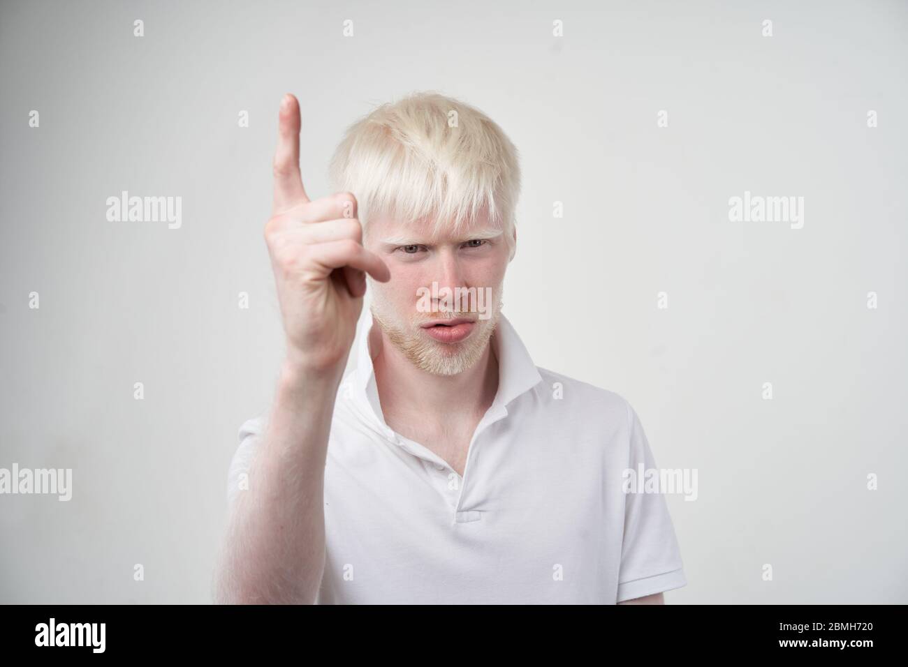 Triste albino homme peau blanche cheveux studio habillé t-shirt isolé fond blanc. Anomalies. Aspect inhabituel. Anomalie de la peau beau p Banque D'Images