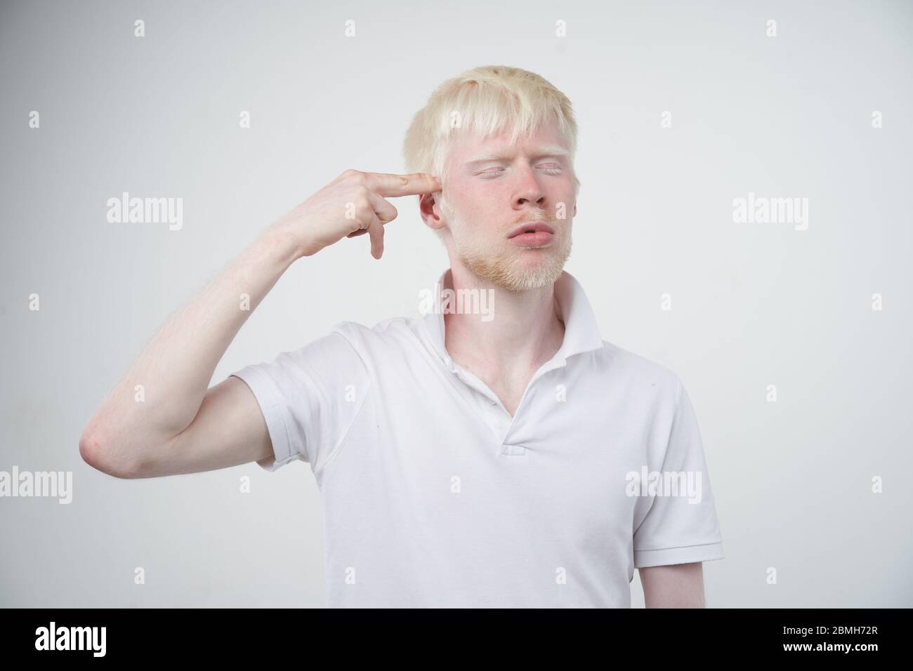 Triste albino homme peau blanche cheveux studio habillé t-shirt isolé fond blanc. Anomalies. Aspect inhabituel. Anomalie de la peau beau p Banque D'Images