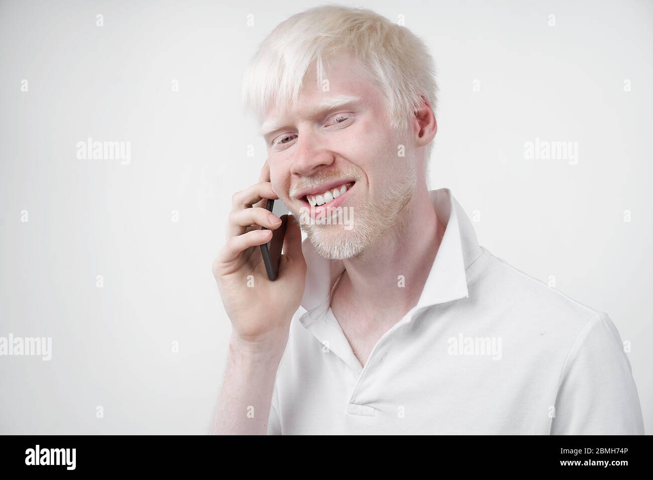 Joyeux sourire albino homme blanc peau cheveux studio habillé t-shirt isolé blanc arrière-plan anormal déviations aspect inhabituel anomalie beau Banque D'Images