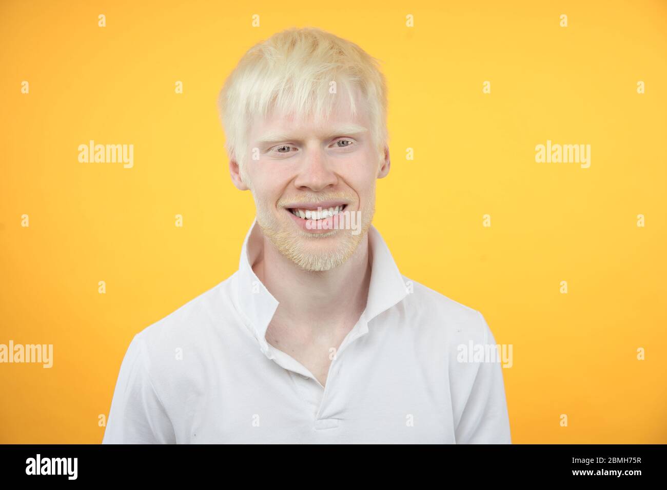 Joyeux sourire albino homme blanc peau cheveux studio habillé t-shirt isolé jaune arrière-plan anomalies aspect anormal anomalie beautifu Banque D'Images