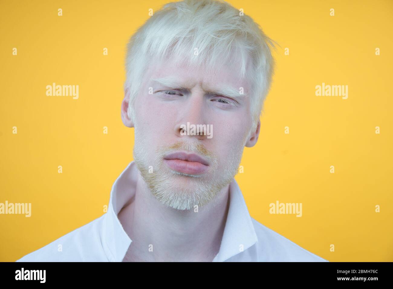 Triste albino homme peau blanche cheveux studio habillé t-shirt isolé fond jaune. Anomalies. Aspect inhabituel. Anomalie de peau beau Banque D'Images