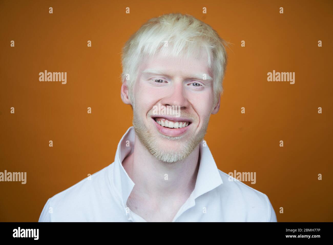 Joyeux sourire albino homme blanc peau cheveux studio habillé t-shirt isolé jaune arrière-plan anomalies aspect anormal anomalie beautifu Banque D'Images