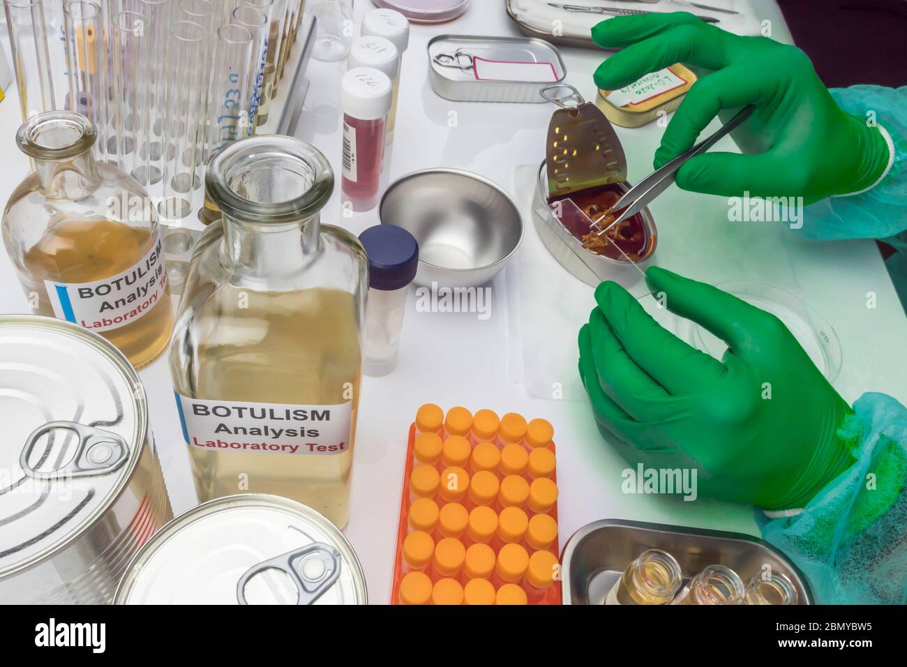 Un laboratoire scientifique expérimenté analyse un échantillon d'une boîte de conserve, infection botulisme chez les malades, image conceptuelle Banque D'Images