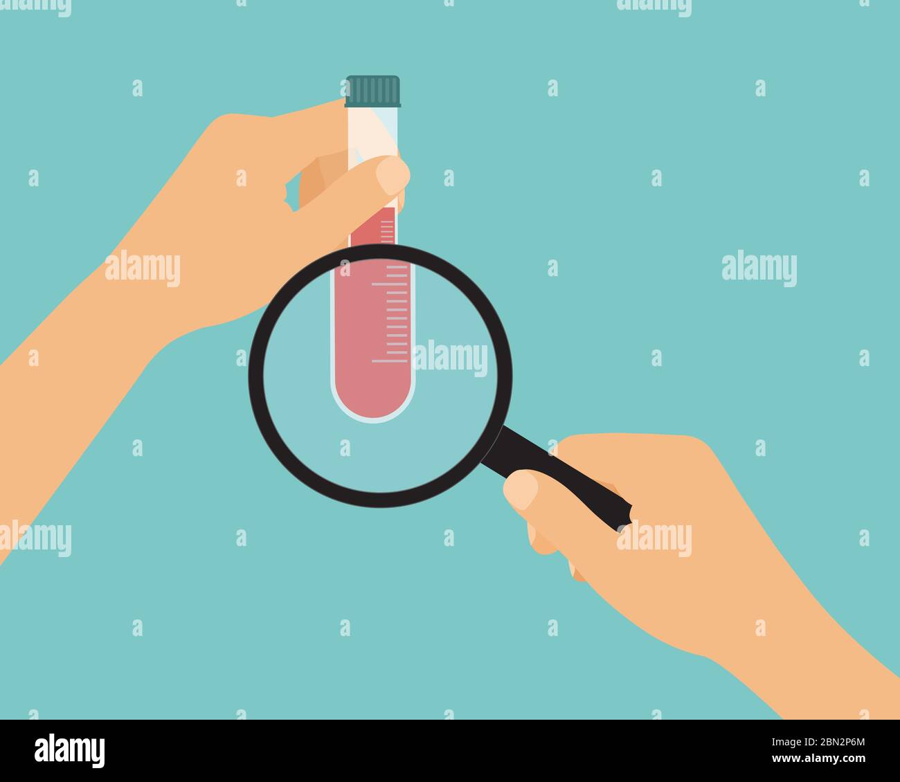 Dessin animé plat illustration de la main scientifique ou médecin avec tube à essai plein de sang pour analyse avec loupe - vecteur Illustration de Vecteur