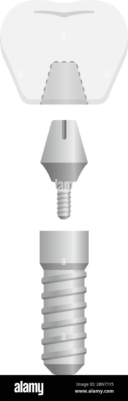 Illustration du vecteur plat de l'implant dentaire (pas de texte) Illustration de Vecteur