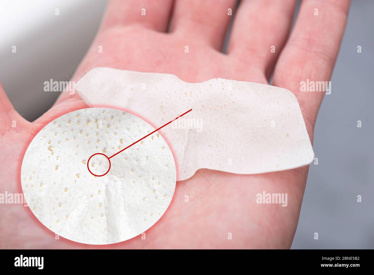 Comedon Banque D Image Et Photos Alamy