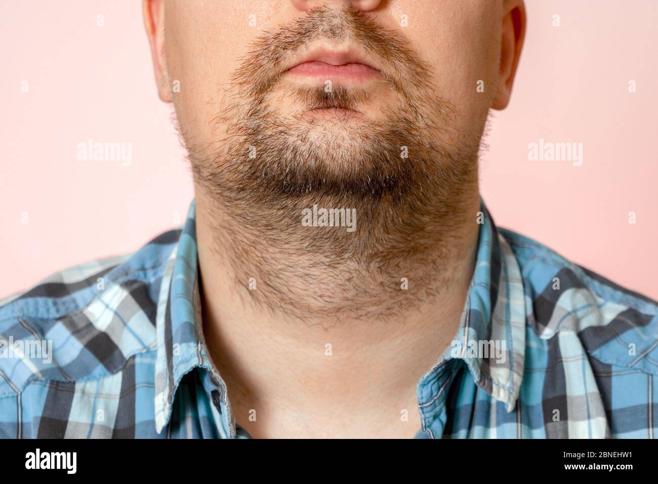 Portrait d'un jeune homme avec un chaume non formé, non taillé, surcultivé.  Cheveux sur le visage et le cou. Barbe courte Photo Stock - Alamy