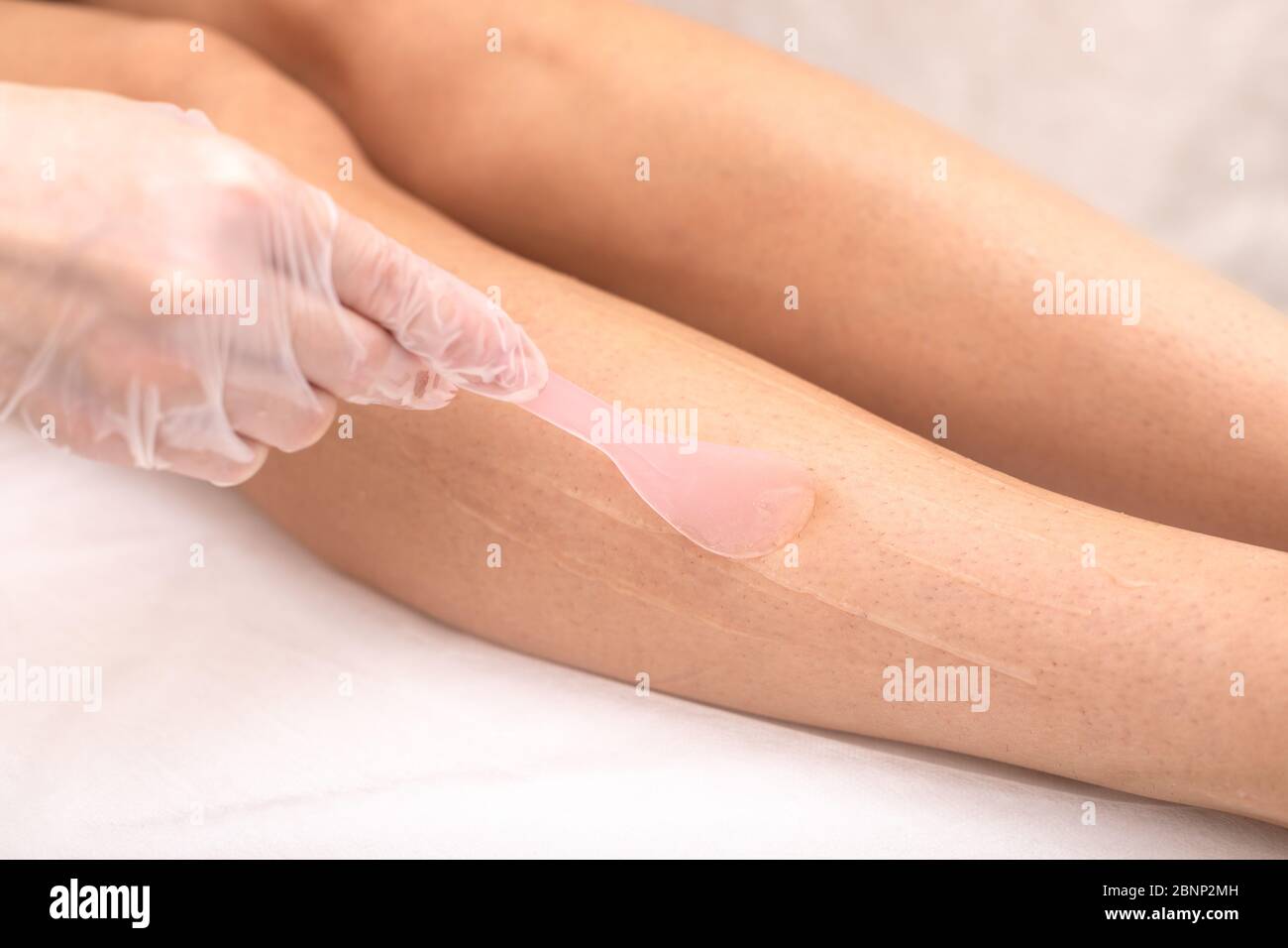 Épilation au laser des jambes, par irradiation. Appliquer une crème de refroidissement sur la peau avant la procédure. Mains dans des gants, gros plan en studio. Con Banque D'Images