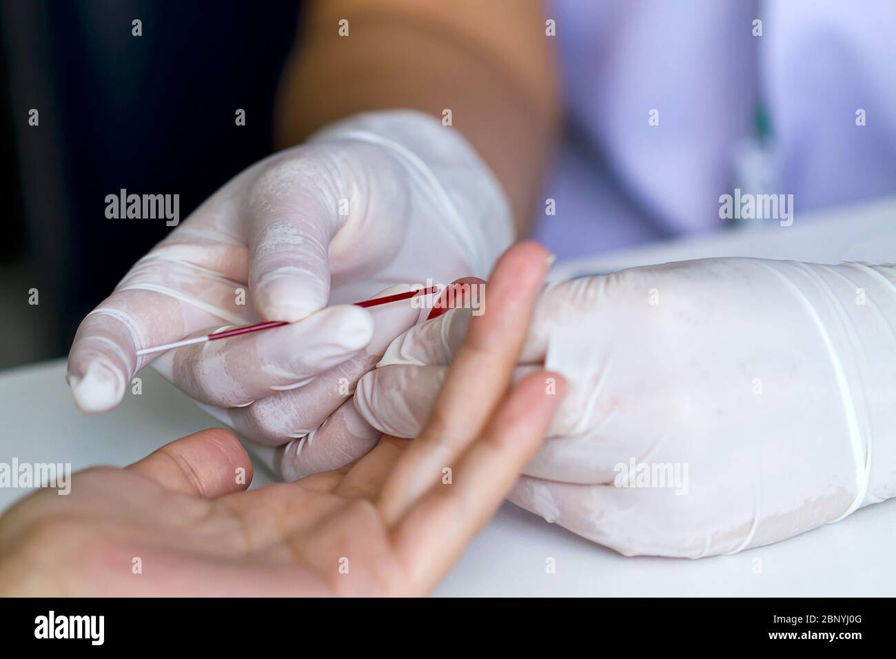 Main du médecin avec un gant blanc montrer le test sanguin par lancet de sang à l'hôpital. Banque D'Images