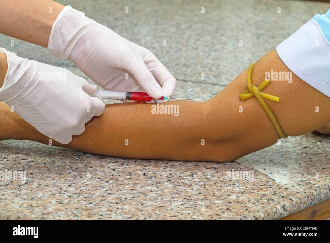 Test sanguin de la veine veineuse du patient par un médecin féminin en gants médicaux blancs sur la table en marbre Banque D'Images