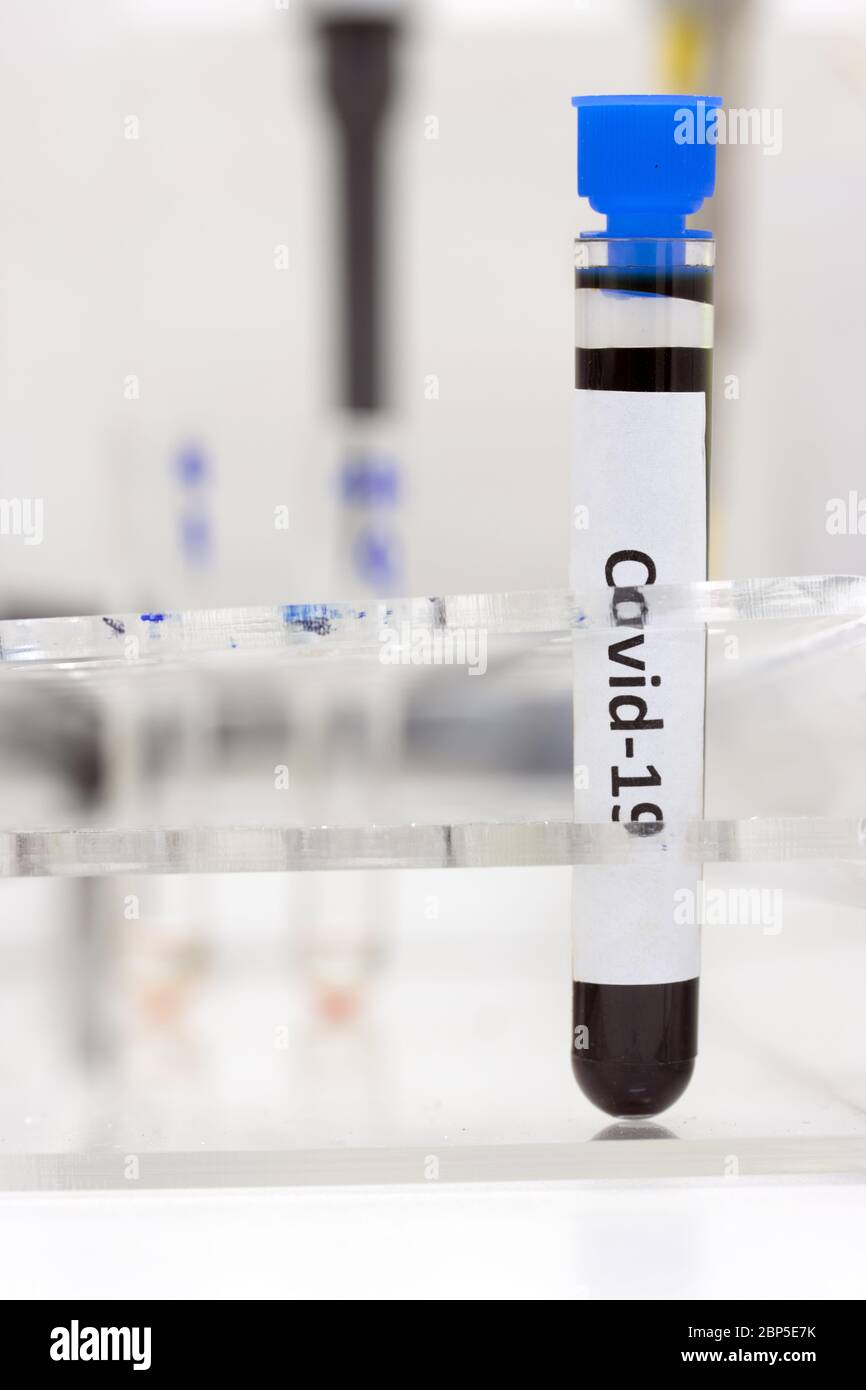 Un tube à essai avec l'inscription Covid-19 se trouve dans un rack sur une table dans un laboratoire. Prélever avec du sang dans le laboratoire. Recherche de sang de patient. Banque D'Images