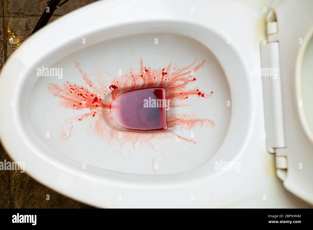 L'urine est rouge sang urine dans le réservoir de chasse d'eau dans la  salle de bain, mélange de pipi bloody Photo Stock - Alamy