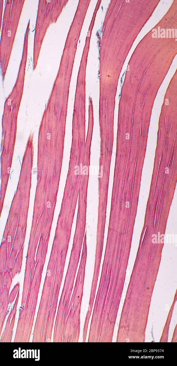 Tissu musculaire strié, vue au microscope Banque D'Images