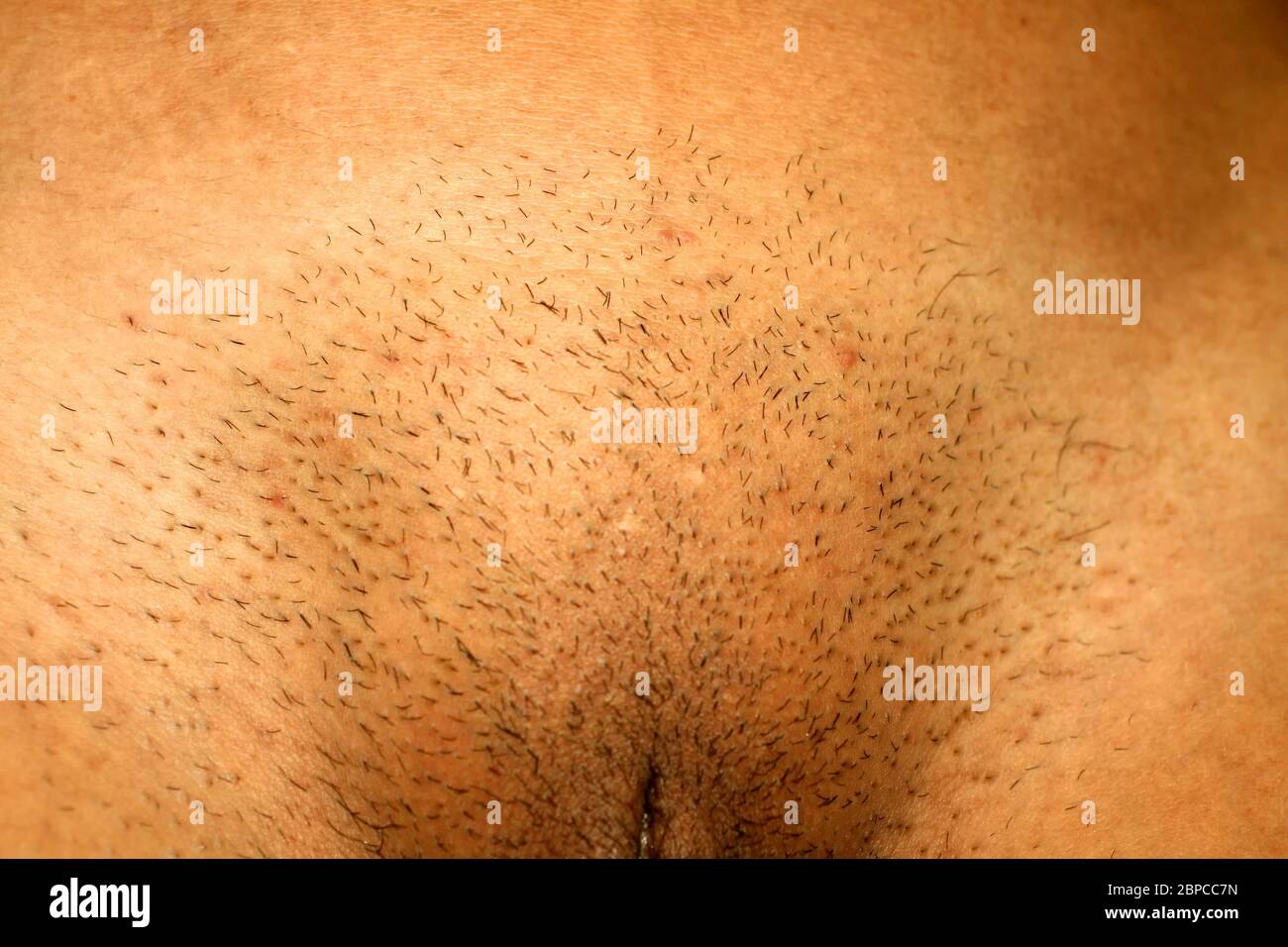 Pubis femme Banque de photographies et d’images à haute résolution Alamy — free download