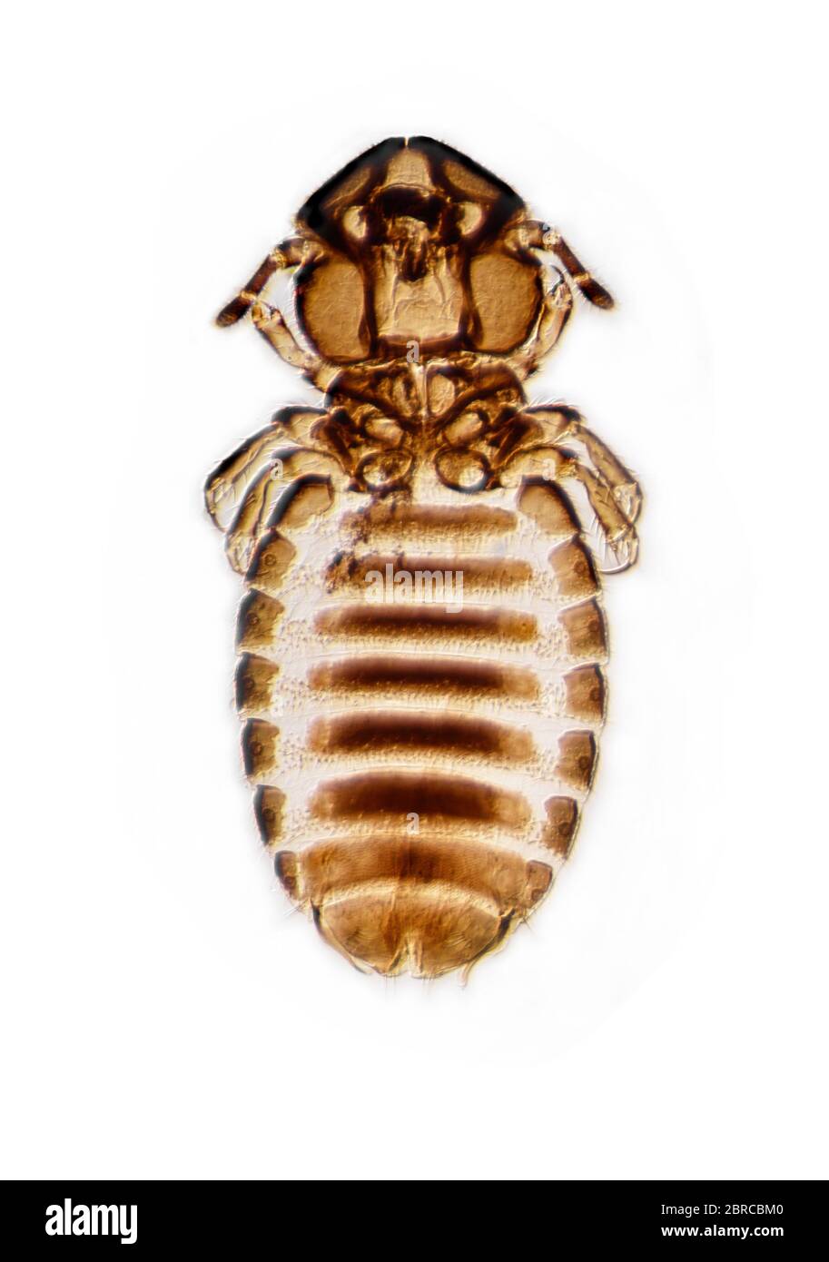 Anoplura souris, ectoparasites d'oiseaux et de mammifères qui nourrissent le sang. Photomicrographe à fond clair Banque D'Images