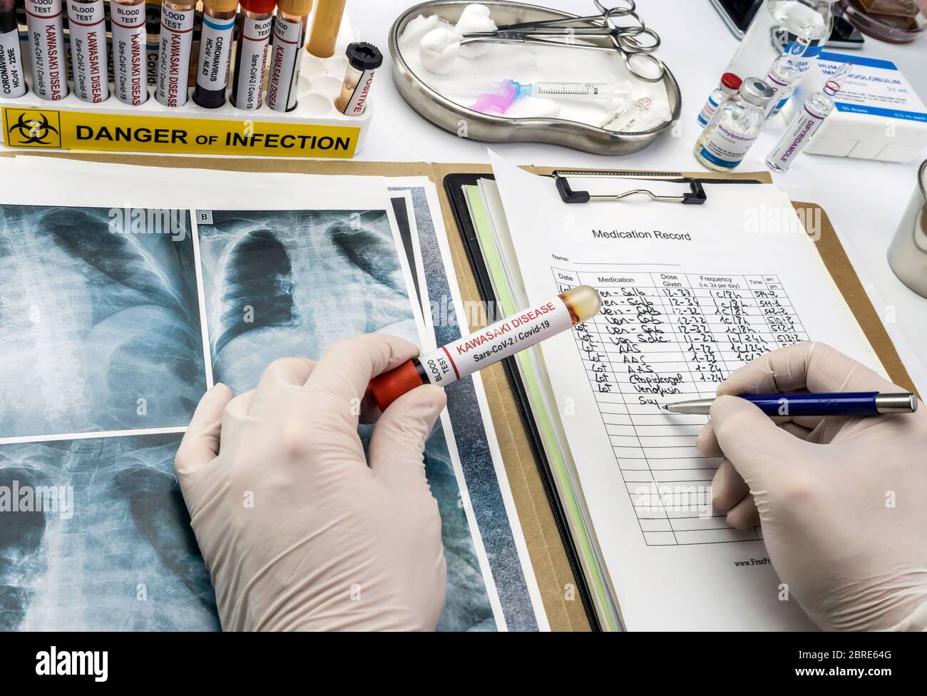 Le médecin détecte les résultats dans la pulmonaire d'un enfant affecté par la maladie de Kawasaki avec plusieurs échantillons de sang dans un hôpital, image conceptuelle Banque D'Images
