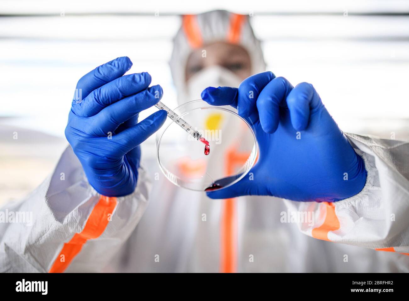 Vue de face du médecin analysant des échantillons de sang, concept du coronavirus. Banque D'Images