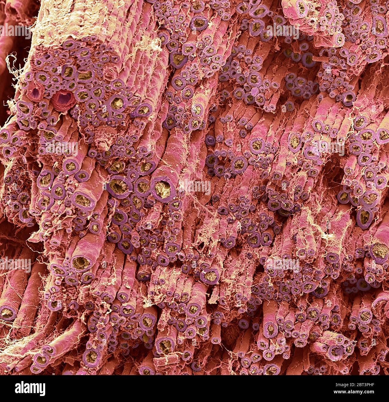 Nerf. Micrographe électronique à balayage coloré (SEM) d'une fracture de gel à travers un nerf périphérique. Les cellules de Schwann enveloppent leur membrane cellulaire autour du nerf un certain nombre de fois. Entre chaque couche de membrane cellulaire se trouve une couche de myéline (rose), une couche grasse électriquement isolante. Une cellule de Schwann épaissit efficacement la membrane d'un nerf et augmente la vitesse à laquelle les impulsions nerveuses sont relayées. La myéline entoure les axones (crème). Le tissu conjonctif endoneurial (jaune) enveloppe les fibres nerveuses. Agrandissement : x150 lorsqu'il est imprimé à 10 centimètres de large. Banque D'Images