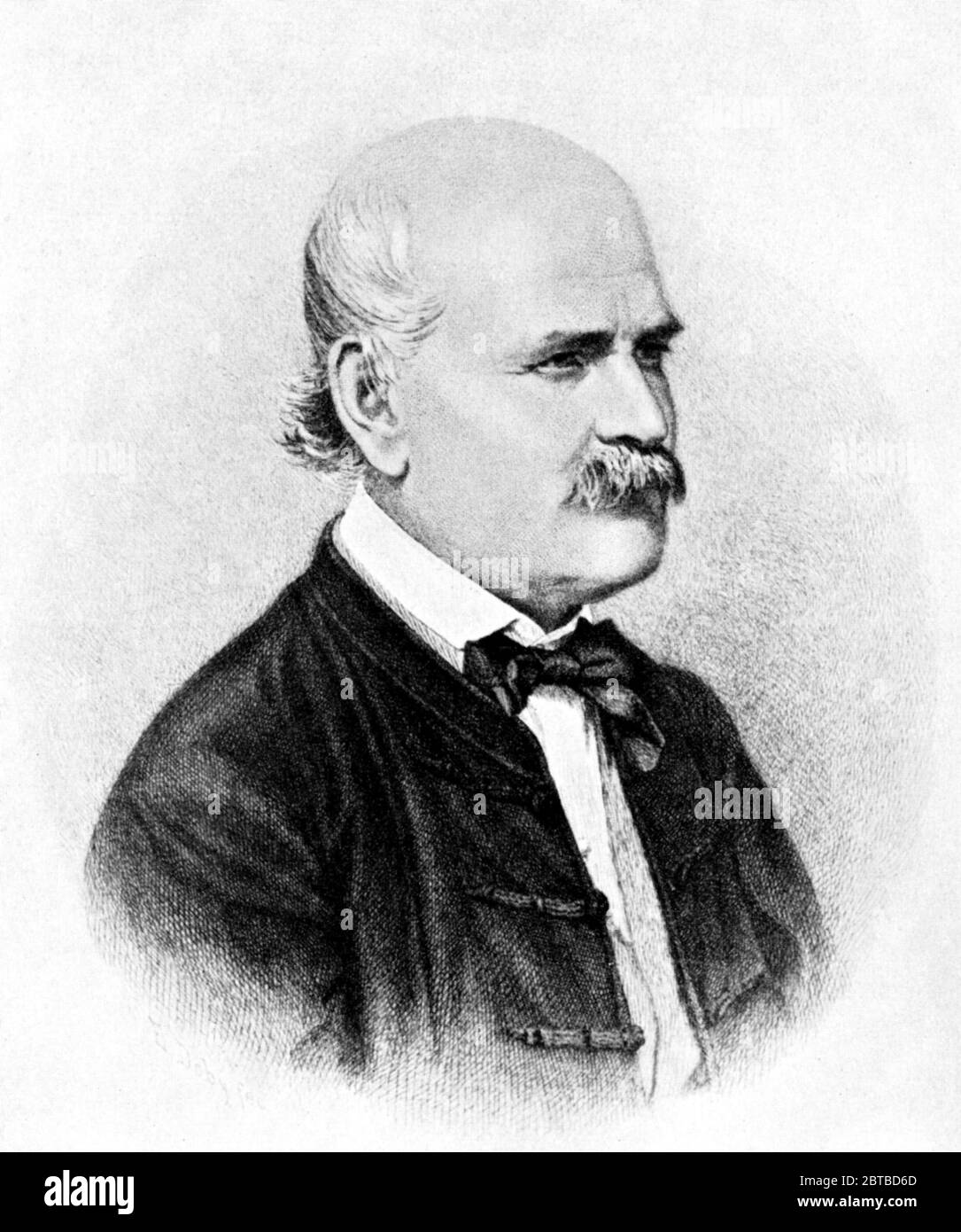 1860 , AUTRICHE : le médecin et scientifique hongrois-autrichien IGNAZ PHILIPP SEMMELWEIS ( 1818 - 1865 ). Maintenant connu comme un pionnier précoce des PROCÉDURES ANTISEPTIQUES . Proposer la pratique de se laver les mains avec des solutions de chaux chlorée en 1847 pour la bataille de la FIÈVRE PUERPÉRALE . - chirurgien - SCRITTORE - ÉCRIVAIN - LETTERATURA - LITTÉRATURE - foto storiche - foto storica - scienziato - scientifique - DOTTORE - MEDICO - MEDICINA - médecine - SCIENZA - SCIENCE - SCIENZIATO - IGIENE - LAVARE LE MANI - LAVAGGIO - VIRUS - VIROLOGIA - PROCEDURE VIROLOGISTALISEE ANTISETTICHE - SETTICEMIA --- ARCHIVIO G. Banque D'Images