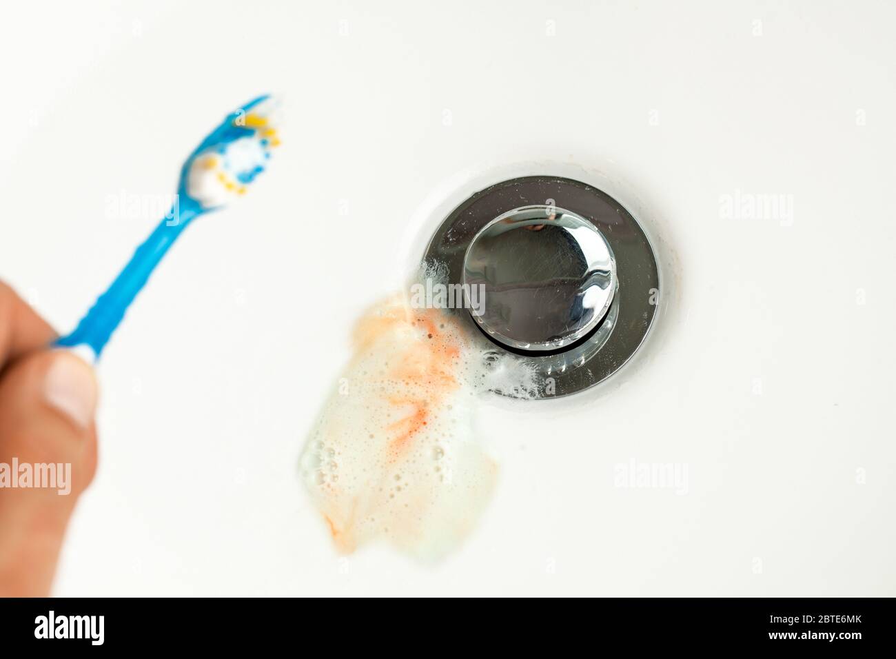 Dentifrice avec du sang dans l'évier après avoir brossé vos dents. Saignements des gencives. Banque D'Images