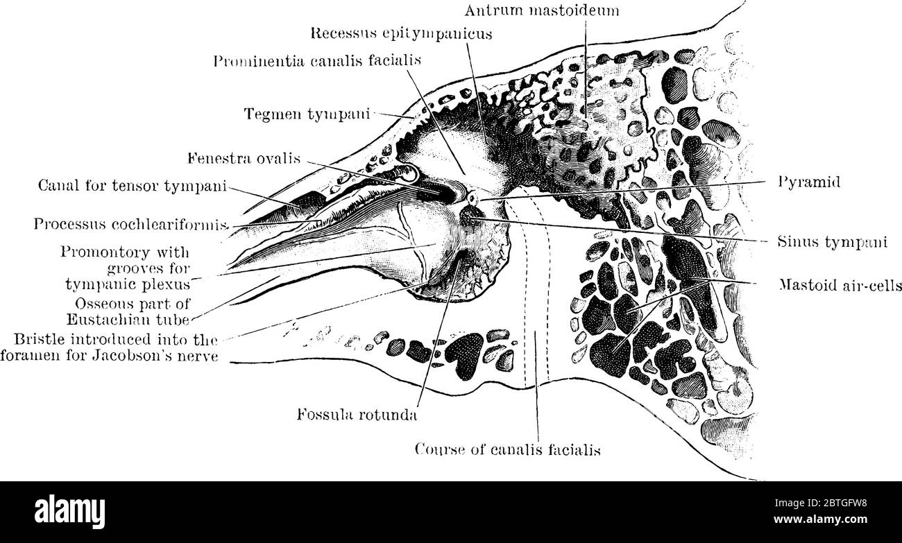 La section à travers l'os temporal gauche, montrant la paroi interne de la cavité tympanique, avec ses parties étiquetées, dessin de ligne vintage ou gravure illustrat Illustration de Vecteur