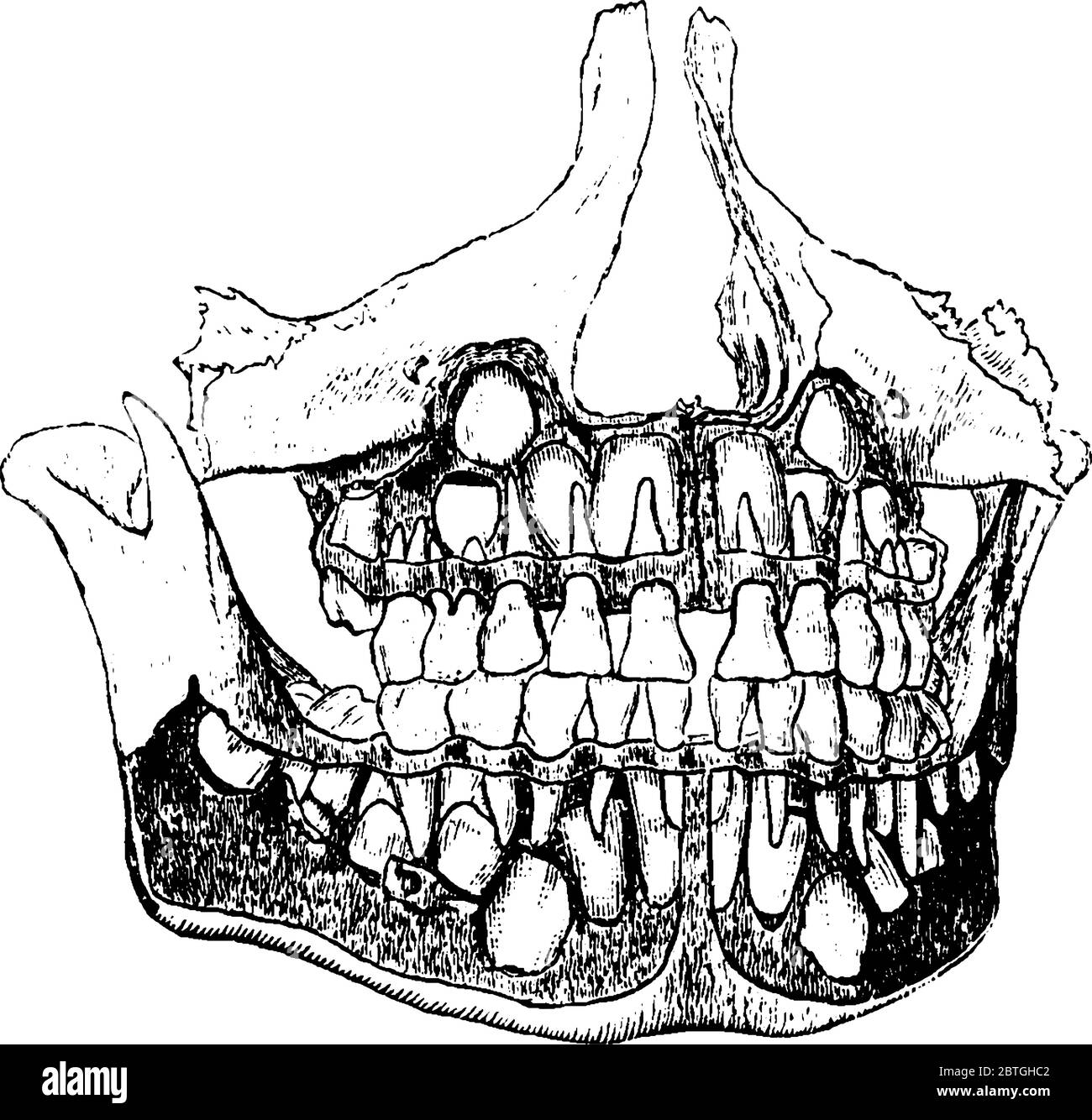 Schema De La Machoire Bebe Montrant Les Dents Temporaires Et Permanentes Dessin De Ligne Vintage Ou Illustration De Gravure Image Vectorielle Stock Alamy Schema De La Machoire Bebe Montrant Les Dents Temporaires Et Permanentes Dessin De Ligne Vintage Ou Illustration De Gravure Image Vectorielle Stock Alamy
