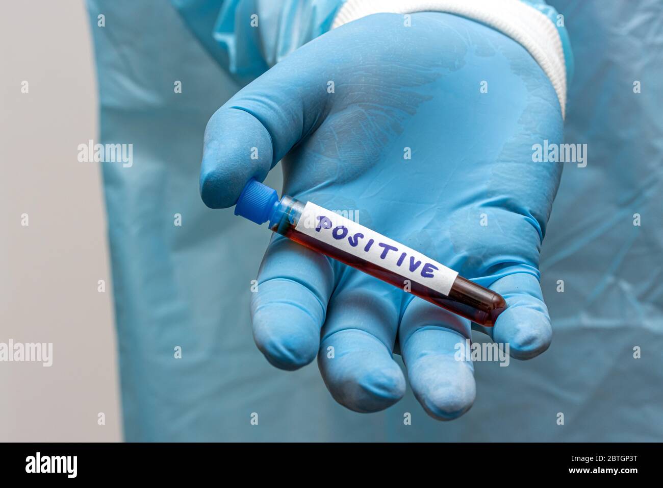 Un médecin présente un tube à essai avec des résultats positifs. Main gantée tenant un tube à essai avec du sang. Une recherche en laboratoire du sang. Banque D'Images