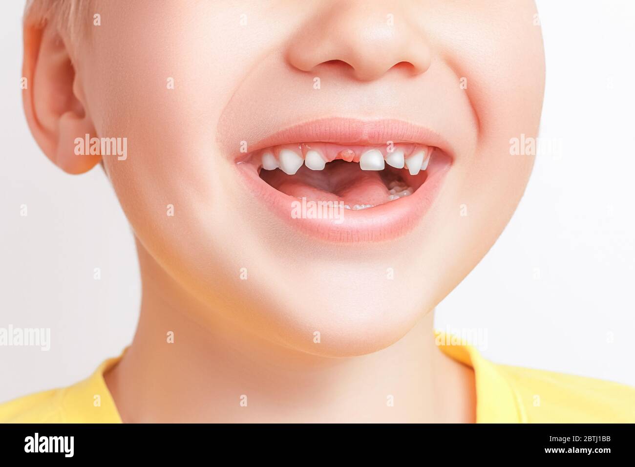 Joyeux sourire, un garçon caucasien montrant la première dent de lait tombée. Gros plan de la bouche ouverte sans dent. Banque D'Images