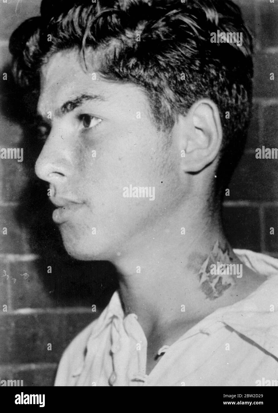 Melvin Bridge, un étudiant juif de 15 ans de l'école secondaire Gwynn Falls Jr à Baltimore, Maryland, a été marqué d'une lettre H - apparemment pour l'hébreu - par des camarades de classe pro-nazis. La marque était sur le cou du garçon avec un instrument pointu. 18 élèves de l'école ont été suspendus à la suite de l'incident et une enquête approfondie sur un présumé Bund Junior, une organisation nazie de l'école, est en cours. Photos : la marque sur le cou du pont Melvin. 19 juin 1939 Banque D'Images