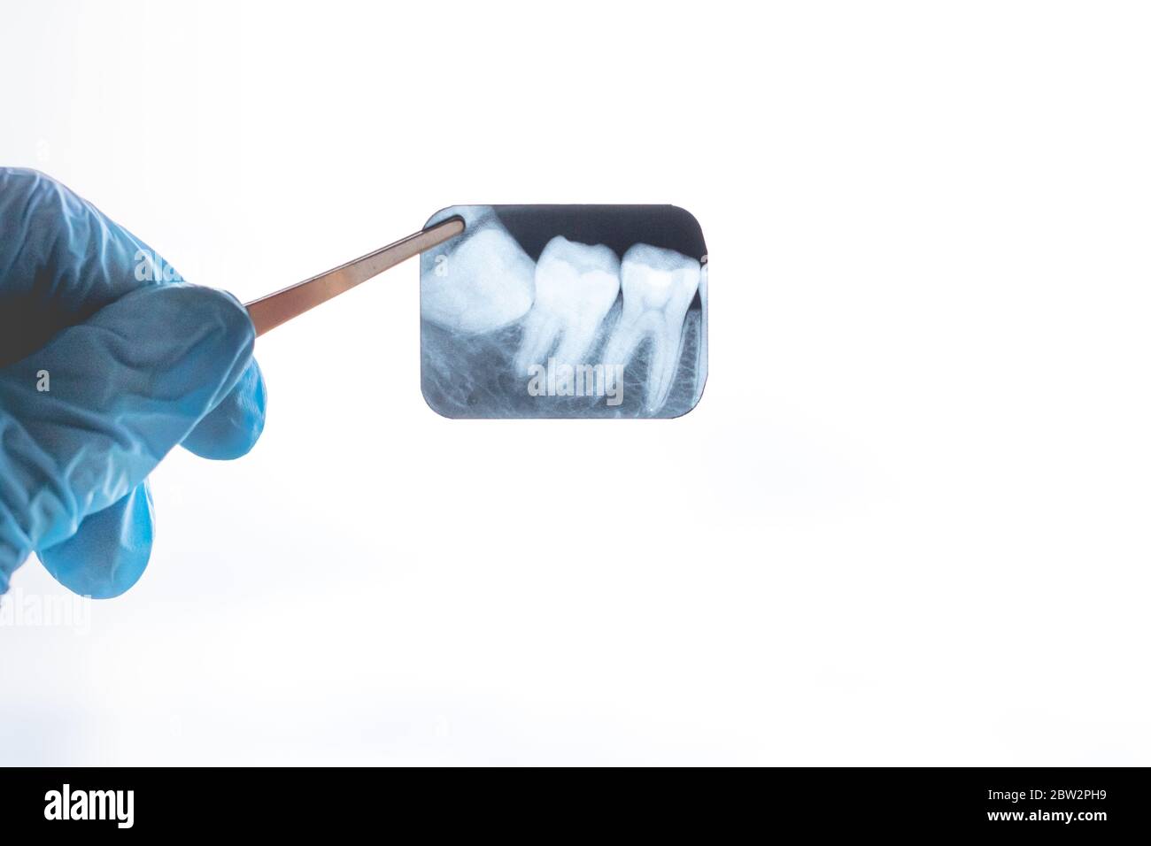 Rayons X des dents de sagesse dans les mains du dentiste Banque D'Images